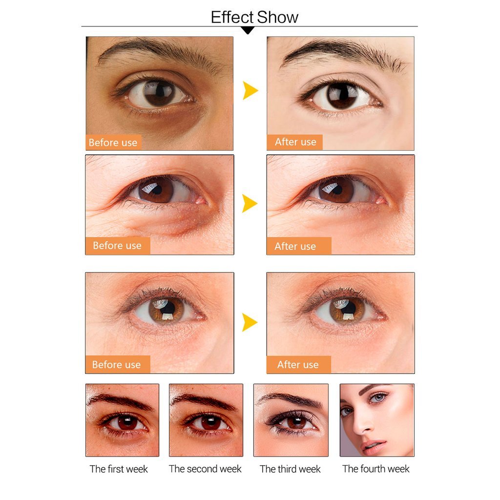Dr.Rashel Ruby Nutrition Hydrogel Eye Mask