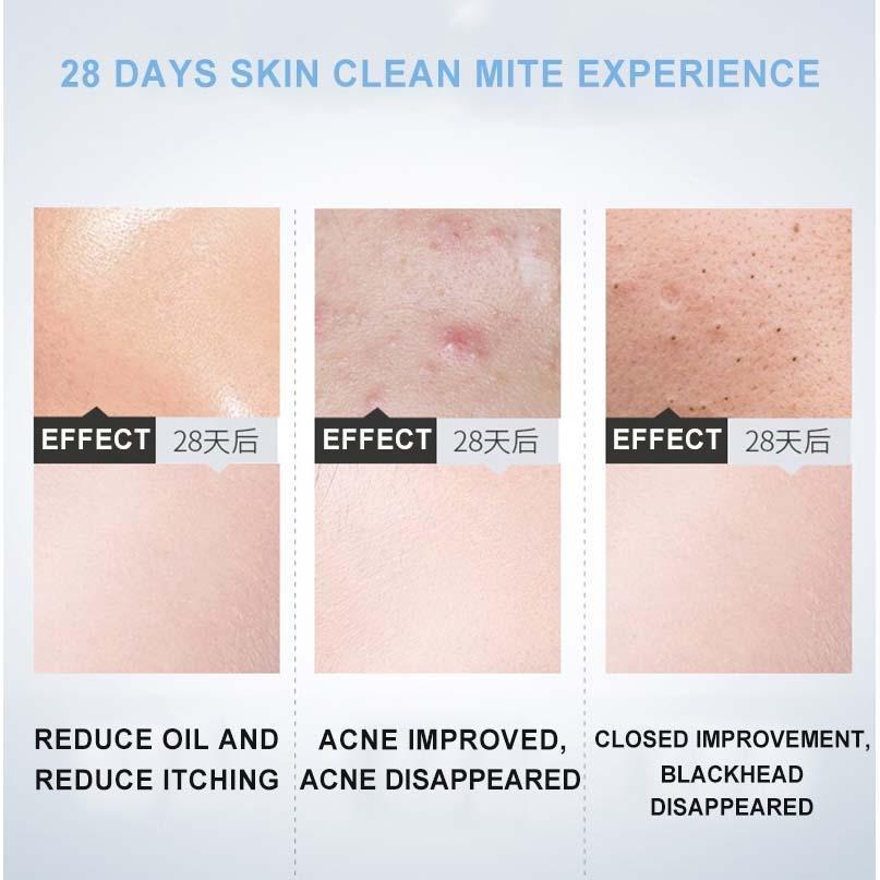 Dr.Rashel Hyaluronic Acid Essence Cleansing Mousse