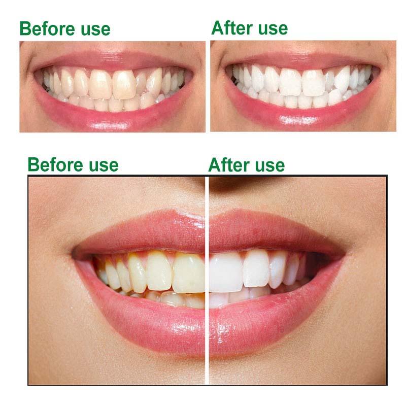 Dr.Rashel Aloe Vera Teeth And Gum Protection Toothpaste