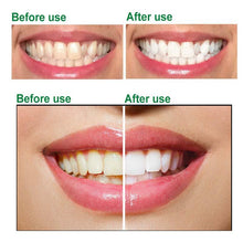 Load image into Gallery viewer, Dr.Rashel Aloe Vera Teeth And Gum Protection Toothpaste

